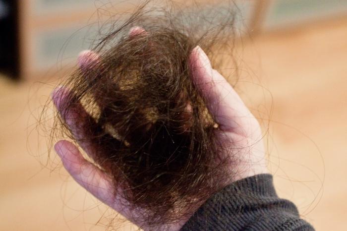 o que fazer se o cabelo cair fortemente nas mulheres