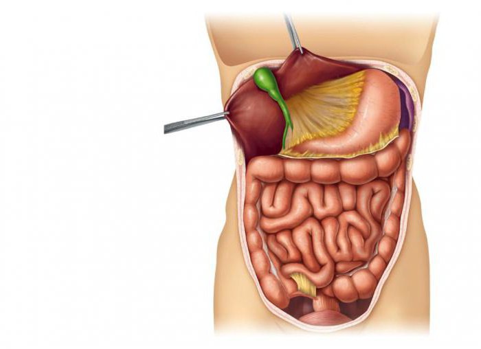 após abscesso apendicular