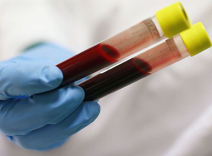 teste de sangue bioquímico que irá mostrar