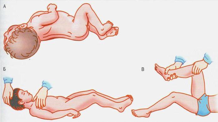 meningite encefalite contagiosa