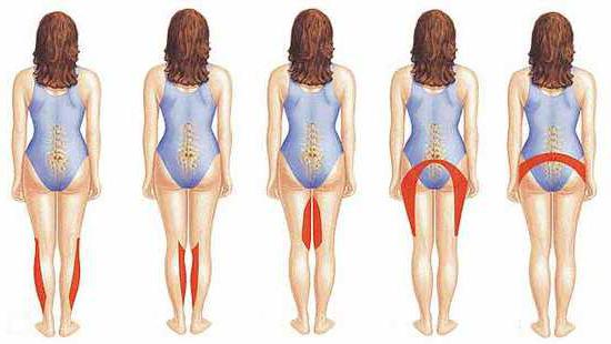 tratamento de protusão discal